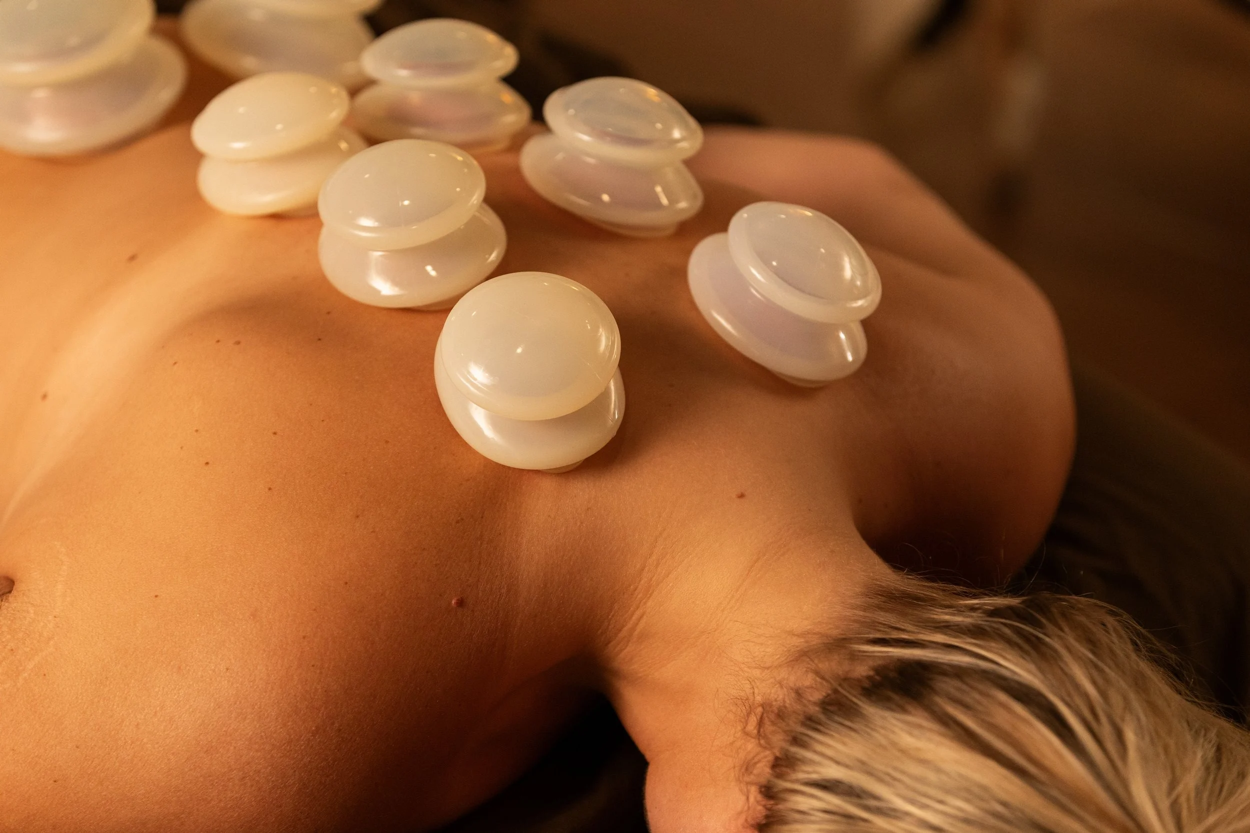 Cupping massage therapy
